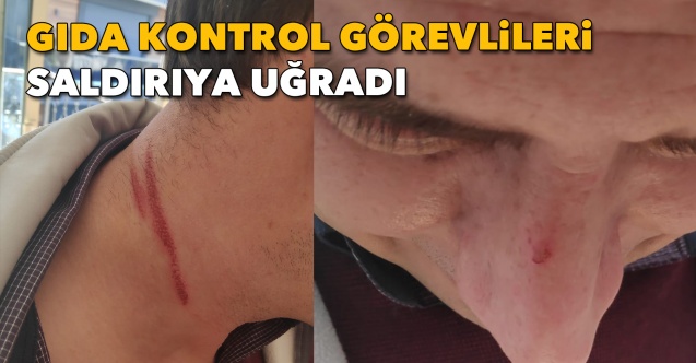 GÖREV YAPARKEN ESNAFIN SALDIRISINA UĞRADILAR, YARALANIP HASTANE KALDIRILDILAR… GÖREV YAPARKEN ESNAFIN SALDIRISINA UĞRADILAR, YARALANIP HASTANE KALDIRILDILAR…